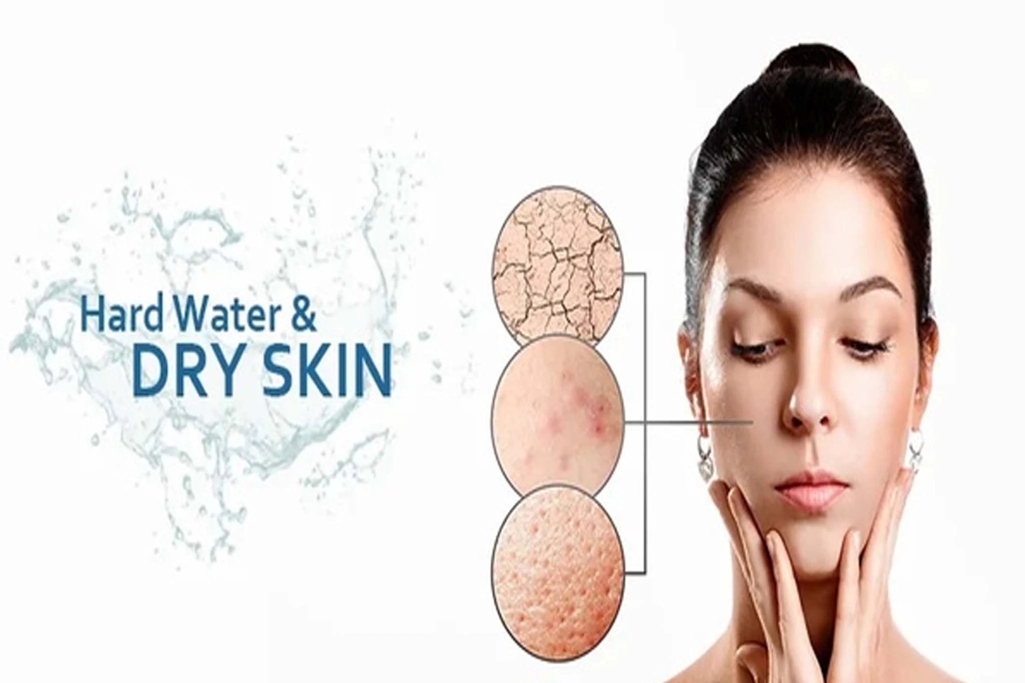 Dry skin and hair problems caused by Phoenix hard water